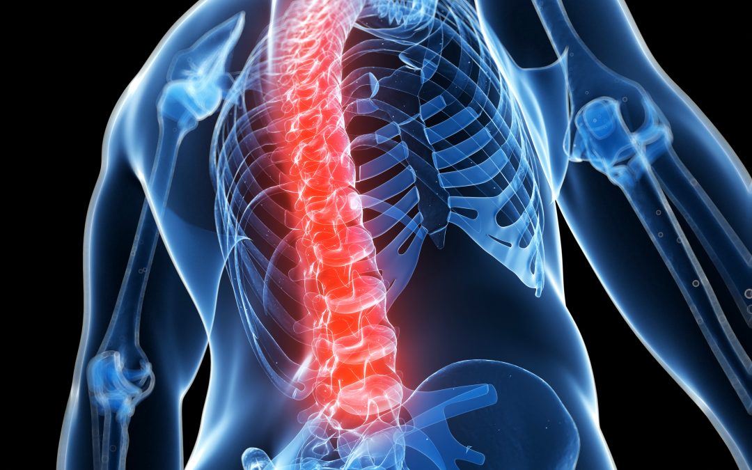 Spinal fluid aids in tracking Parkinson’s progression