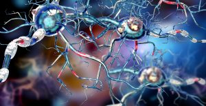 Affected Nerve cells-Parkinson's Movement