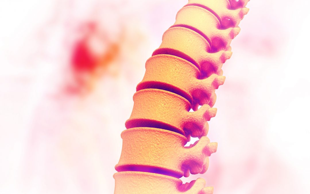 Spinal Cord Stimulation for Freezing